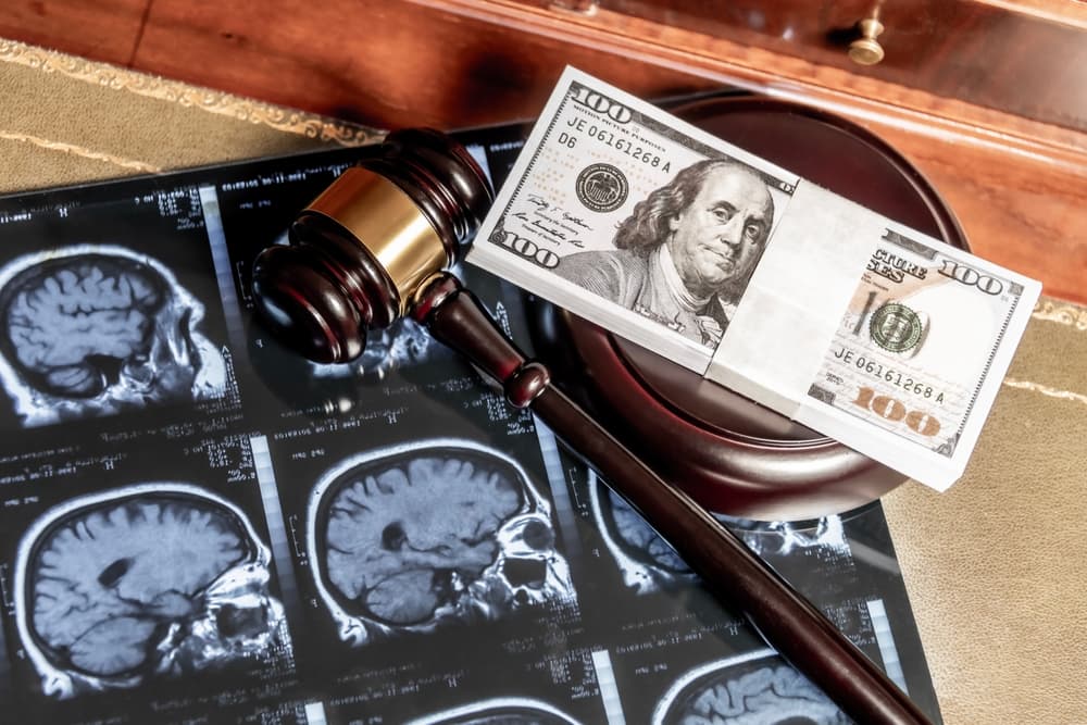 Judge’s gavel and stack of dollar bills placed on brain scan images on a desk.