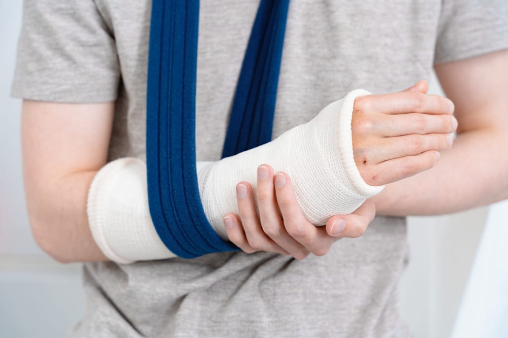 Injured person wearing an arm cast and sling after an accident-related injury, representing bodily injury damages and medical recovery.